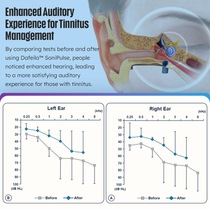 Dafeila™ SoniPulse Tinnitus Relief Soothing Aid 💥Enjoy Special Discounts💥